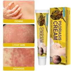 Skin Moss Removal Cream Moss Versicolor Sweat Spot Sweat Spot Itchy Skin Antibacterial Cream Skin Whitening Cream