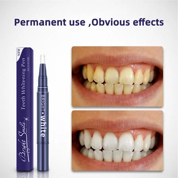 

Teeth Whitening Pen Effective Painless Removal Teeth Plaque Stain Oral Hygiene Cleaning Tooth Bleaching Dental Tools 2020