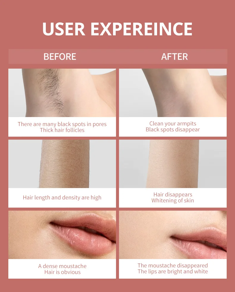 Ipl Haarentfernungsgerät Für Damen Und Herren Zur Heimanwendung_voghion.com