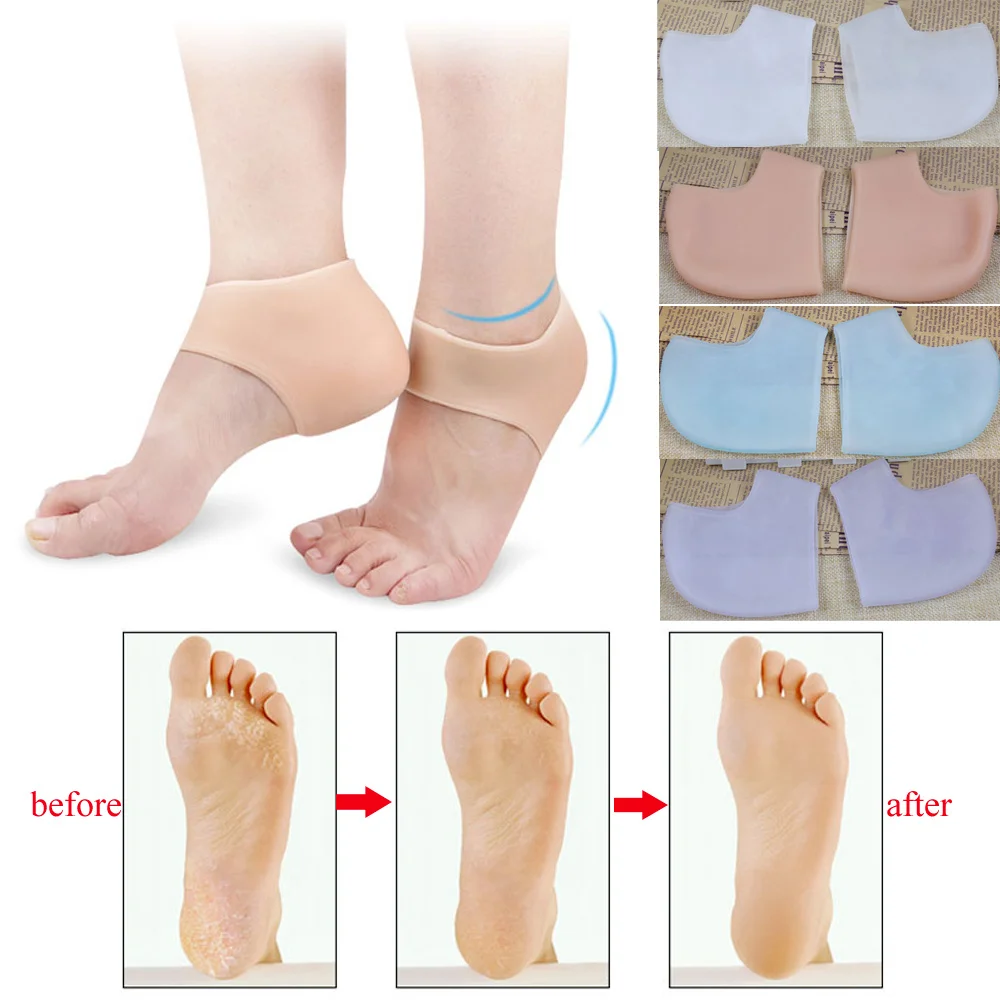 1Pair Plantar Fasciitis Silicone Gel Heel Sleeve Protective Heel Air Support Reduce Pressure, Relief Pain and Cracked