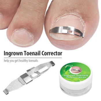 

Ingrown Toenail Corrector Orthotic Nail Corrector Pedicure Tool Toenail Correction Treatment Tool Foot Nail Care Tool