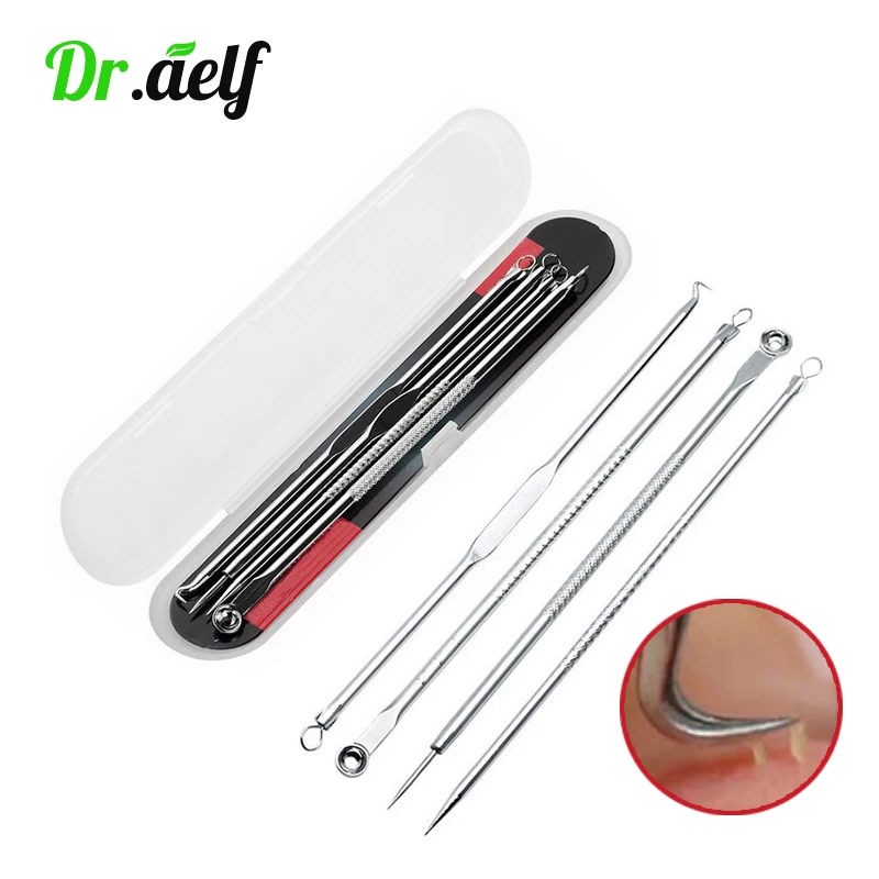 

4PCS/set Stainless Steel Extractor Pimple Blackhead Remover Needles Acne Blemish Removal Tweezer Spoon Clean Face Skin Care Tool