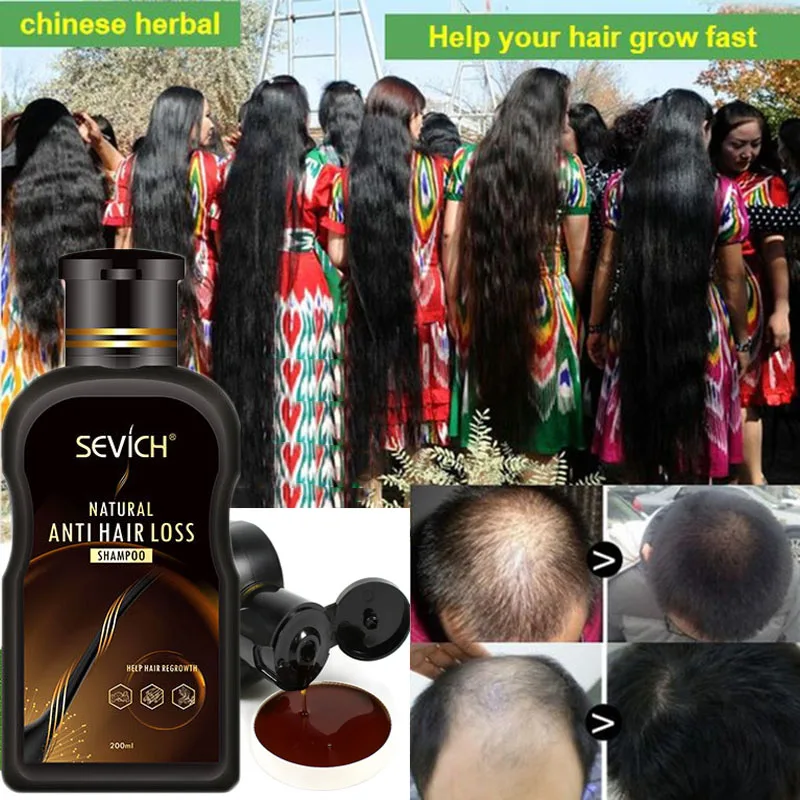 Fresco do Crescimento do Cabelo do Tratamento Eficaz do Champô do Soro do Crescimento do Cabelo da Perda de Cabelo do Gengibre do Produto dos Cuidados com o Cabelo Líquido Cabelo Gengibre Produto dos Cuidados com o 200ml Anti de do