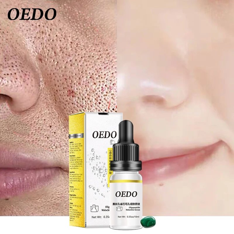 OEDO термоусадочная поры олигопептид Малахитовый жидкий крем для лица