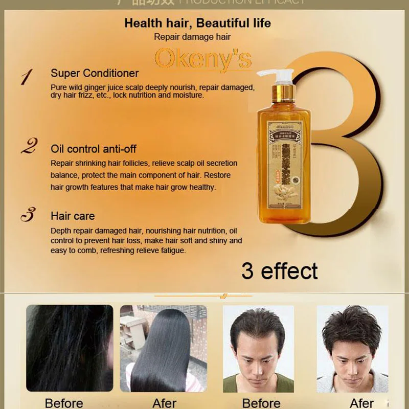 Professional Hair ginger Shampoo Hair regrowth Dense Fast Thicker Shampoo Anti Hair Loss Professional Hair ginger Shampoo Hair regrowth Dense Fast Thicker Shampoo Anti Hair Loss