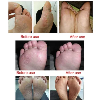 

New Horse Oil Foot Cream Nutritional Moisturizing Anti Wrinkle Remove Fungus Skin Care SCI88