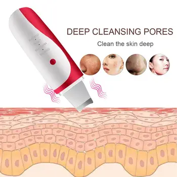 

Blackhead Removal Equipment Black Head Cleaner Face Beauty Apparatus 2 Color ABS Effective Fashion Fast Skin Care Clean Remove