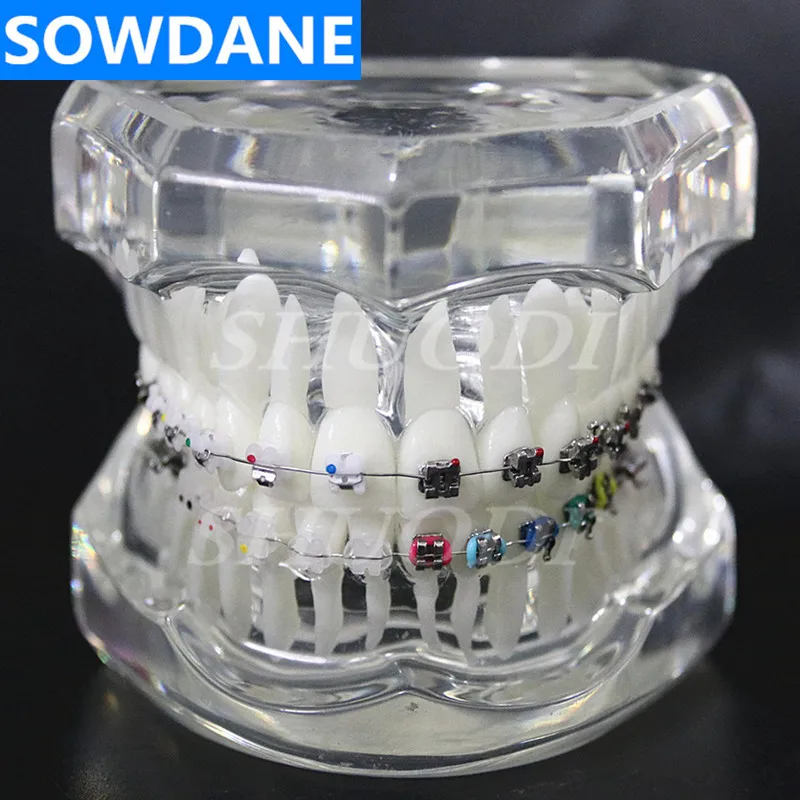 

Dental Orthodontic Model 4 kinds Brackets with Ceramic Self Ligating Bracket Metal Self Ligating with tube archwire ligature