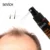 Sevich Hair Growth Essence Spray Hair Loss Treatment Serum Питает Корни Легко Носить С Собой Быстрый Зародышевый Уход За Волосами для Мужчин И Женщин 30 г