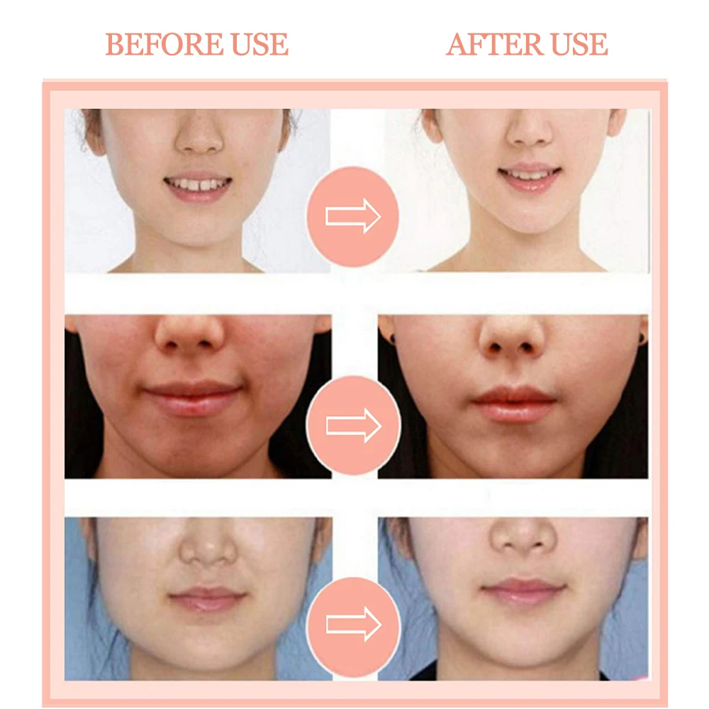 Лифтинг, укрепление V-Shaped Mask одиночный V эластичный двойной висящий ушной глазок пластиковые наклейки для лица для улучшения релаксации отек