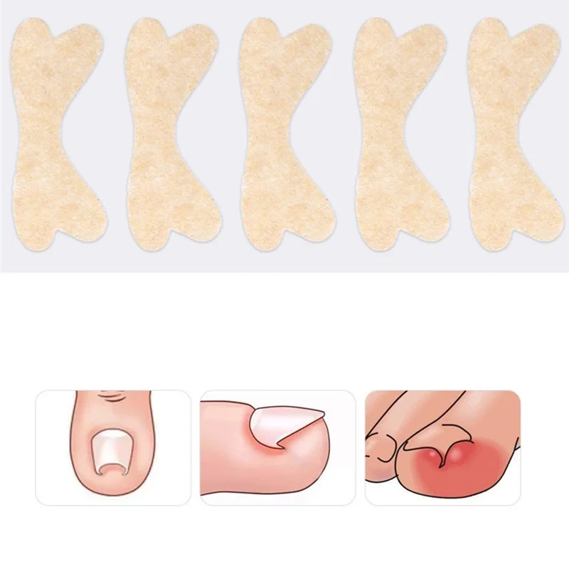 Ingrown Toenail Corrector Sticker Paronychia Treatment Fixer Recover Corrector bunion Pedicure Foot Toe Nail Care Tool