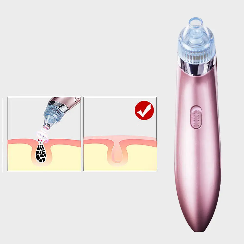 Электронный угорь акне для удаления вакуумной машины дермабразия лицо устройство для очистки пор розовое золото