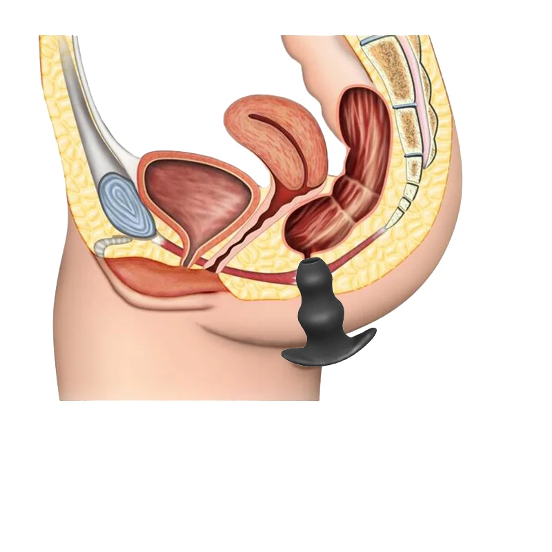Modun силиконовые биде клизмы Анальная пробка увеличить для очистки ануса удлинитель расширитель Гинекологическое зеркало Анальное расширение клизмы душ Анальное отверстие
