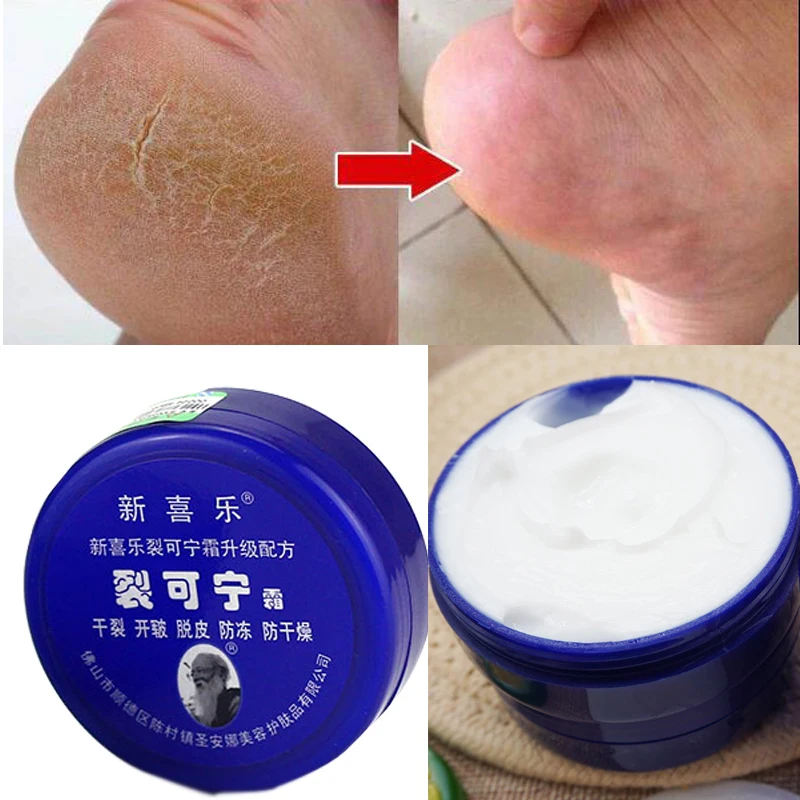 cracked feet cream