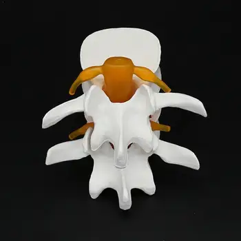 

Medisch menselijk lichaam lumbale hernia lumbale wervelkolom wervelkolom model model orthopedie E9H7