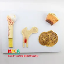 Костная структура модель Cancellous Compact Bone Hover Periosteum хряща обучение медицине Mgt001