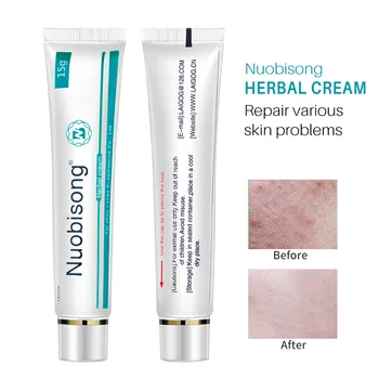 

Nuobisong Natural Herbal Topical Cream Face Pimples Scar Stretch Marks Removal Acne Cream Whiten Face Skin Care Treatment TSLM1