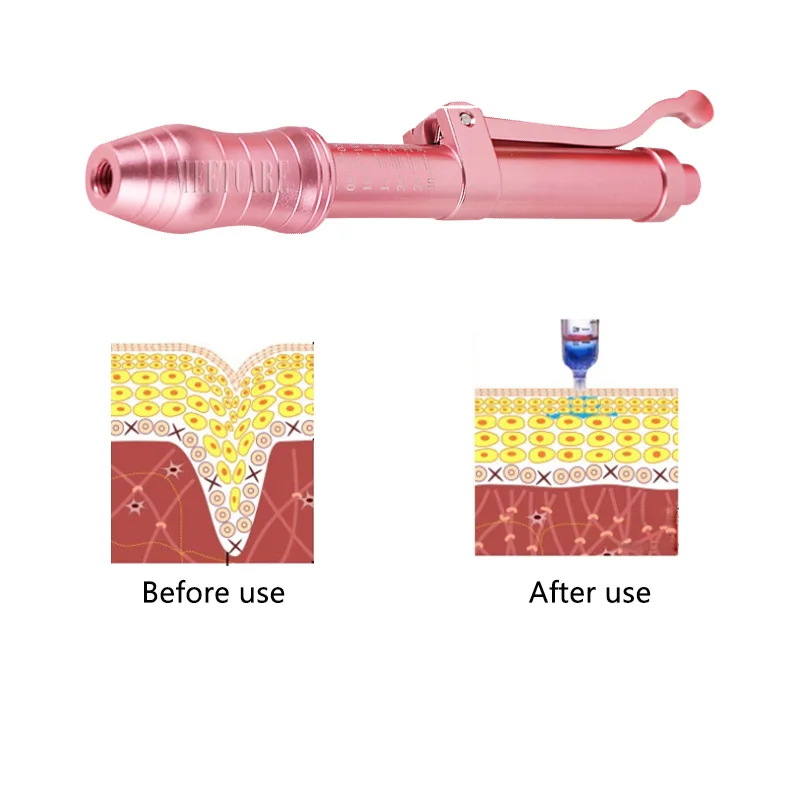 Pink Hyaluronique Pen Hyaluronic Acid Guns No Injection Serum Pen For Anti-wrinkle Skin Rejuvenation Lips Lifting Lip Atomizer