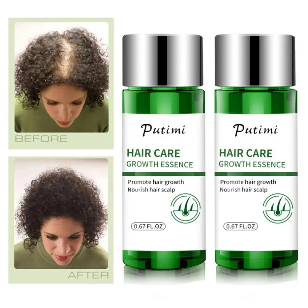Горячая Putimi Уход за волосами рост против выпадения волос Предотвращение здравоохранения Красота Сыворотка для роста густых волос продукты