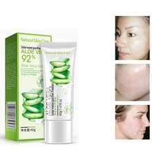 

40g ROREC Natural Aloe Vera Smooth Gel Acne Whitening Treatment Face Cream for Hydrating Moist Repair After Sun Sleeping Mask