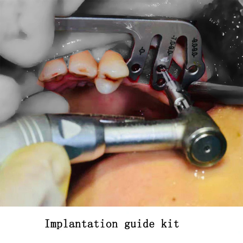 Dentist tools planting positioning angle ruler Dental implants instruments oral planting positioning guide dental implant tools 3