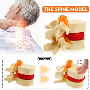 

High Quality Human Lumbar Vertebrae Model Anatomical Medical Props Anatomical Spine Lumbar Disc Herniation Teaching Tool