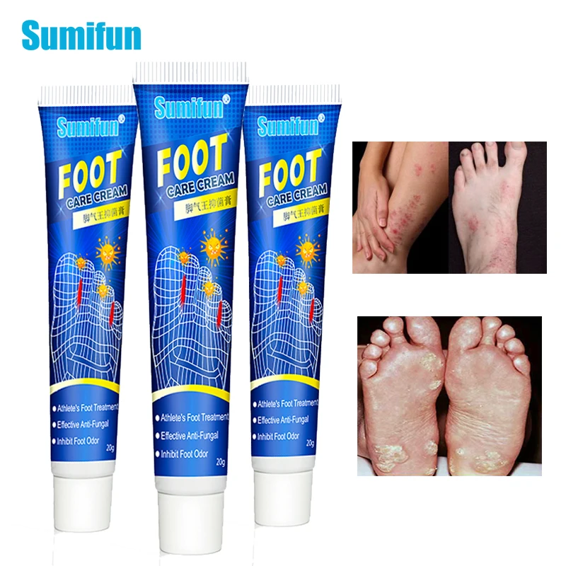 

New 3Pcs Foot Cream Foot Erosive Beriberi Anti Itching Sweat Odor Feet Psoriasis Antibacterial Ointment 20g