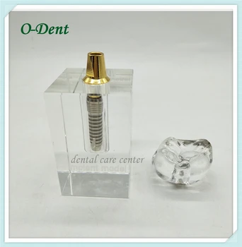 

Dental Implant Repair Teeth Model Dental Implant Tooth Model dentist teaching