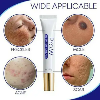

Pro.W Blemish Cream Spots Removal Treatment Pimple Ointment Scar Mark