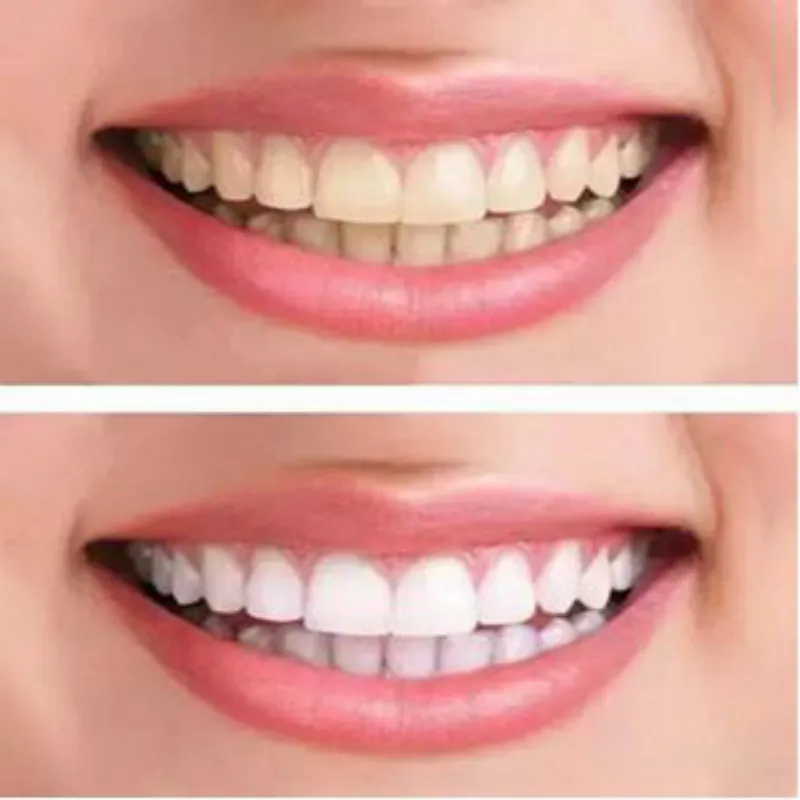 Teeth Whitening Essence Powder Oral Hygiene Cleaning Serum Removes Plaque Stains Tooth Bleaching Dental Tools Toothpaste 1 Teeth Whitening Essence Powder Oral Hygiene Cleaning Serum Removes Plaque Stains Tooth Bleaching Dental Tools Toothpaste 5