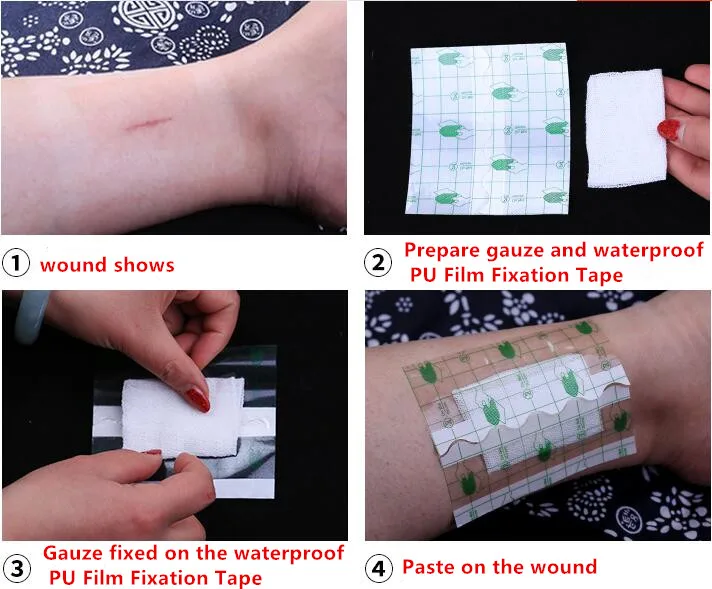 100 шт лейкопластырь Водонепроницаемый Прозрачный клейкий фиксация клейкий бинт намотка фиксатор пленка pu рулон