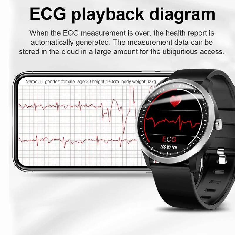 YOCUBY N58 ЭКГ PPG мужские Смарт-часы с электрокардиограммой измерения мужчин t, водонепроницаемый монитор сердечного ритма сна фитнес-трекер