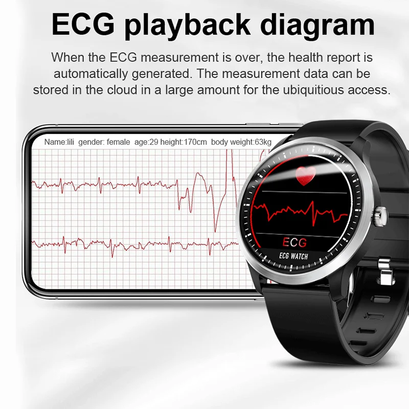 YOCUBY N58 ECG PPG Men Smart Watch with Electrocardiogram MeasurementWaterproof Heart Rate Sleeping Monitor Fitness Tracker