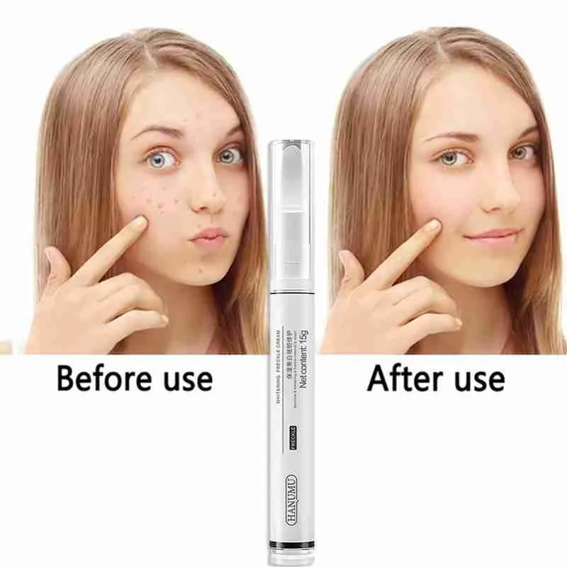 15ml Vitamin C Frekle Cream Whiten Skin Repair Fade Acne Marks Remove Dark Sports Corrector Pen Moisturizing Lotion Serum 15ml Vitamin C Frekle Cream Whiten Skin Repair Fade Acne Marks Remove Dark Sports Corrector Pen Moisturizing Lotion Serum