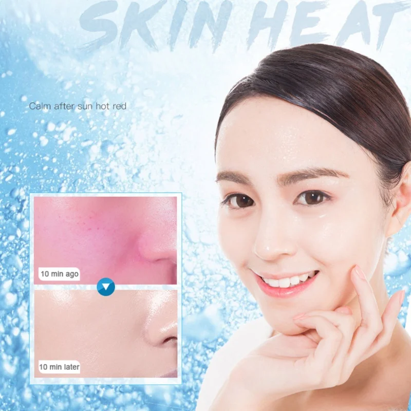 После-sun repair успокаивающий увлажняющий крем для очищения пор носа ледяная маска 1 коробка 10 штук