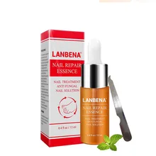 Лечение грибковых ногтей, уход за ногами, отбеливание ног, удаление грибка ногтей, гель против инфекции, пароникция, онихомикоз