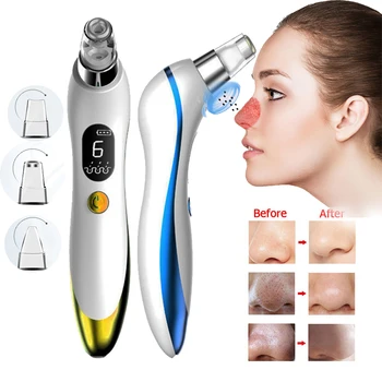 

USB Rechargeable Blackhead Remover Face Pore Vacuum Acne Pore Cleaner Pimple Removal Skin Care Vacuum Suction Tools