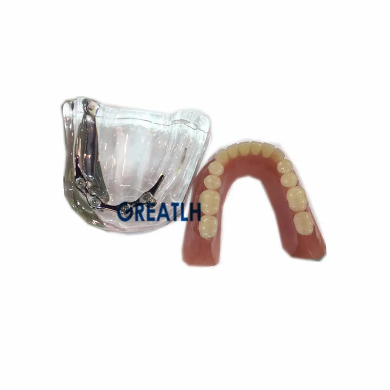 Модель для ремонта зубных имплантов mandibular с серебряной штангой обучающая модель