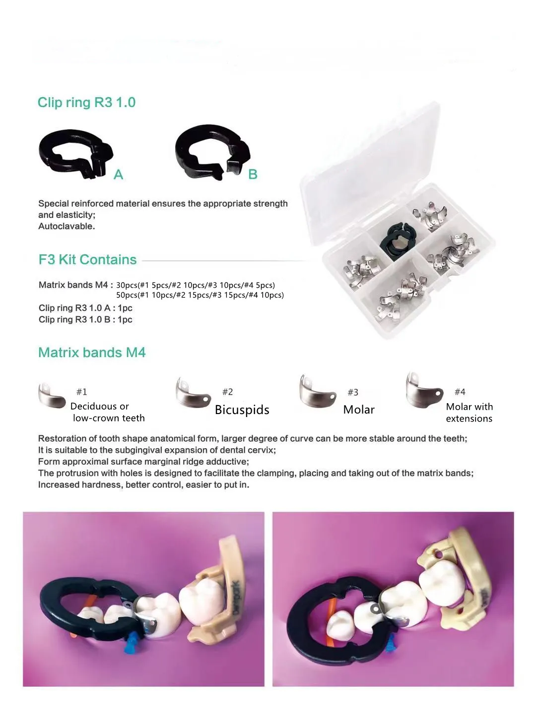 50/30Pcs Dental Schnitts Matrix System Dental Schnitts Konturierte Metall Matrizen Matrix Band Harz Spann Ring Zahnarzt Werkzeuge – Detail 5