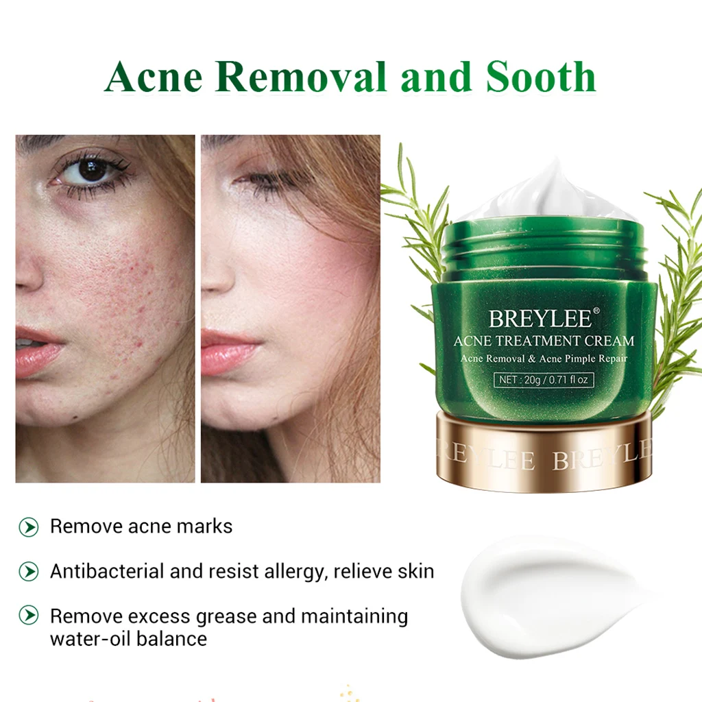 BREYLEE Acne Treatment Face Serum Mask Anti Acne Pimple Scar Remover Moisturizing Whitening Skin Care Facial Essence Cream