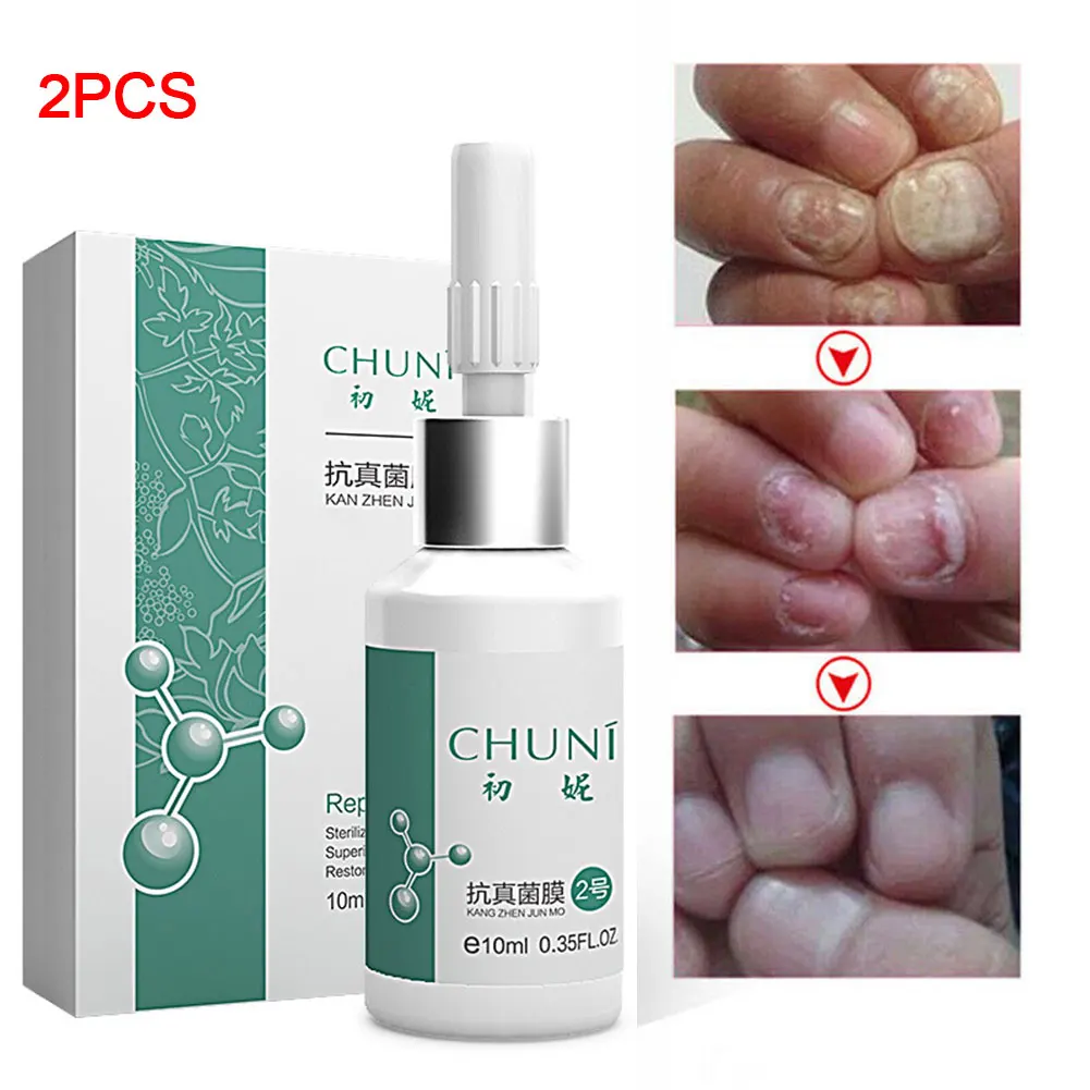 

20ml Accelerate Growth Treatment Ringworm Peeling Leuconychia Harden Portable Antifungal Nail Repair Glue Ointment Relustering