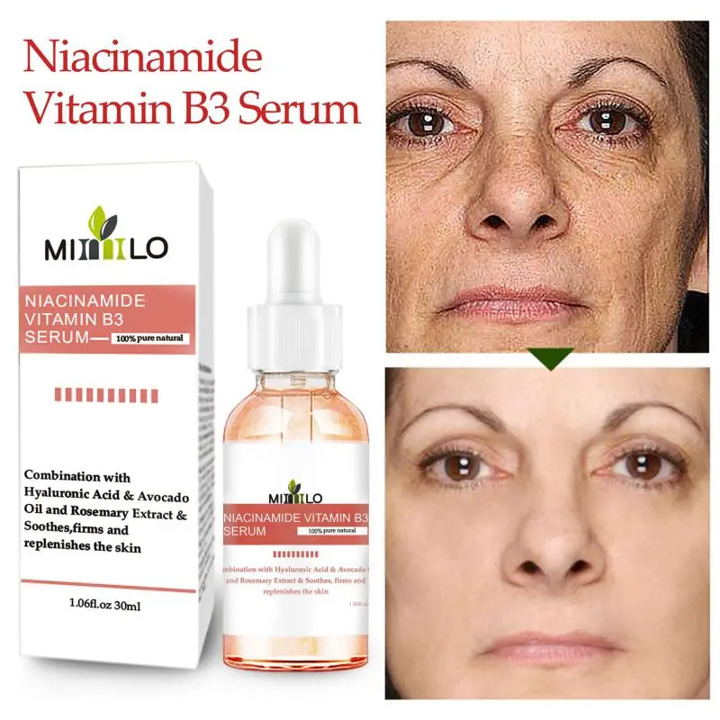 Niacinamide эссенция Увлажняющий Осветляющий пигмент удаляет веснушки осветляет кожу цвет лица Сыворотка