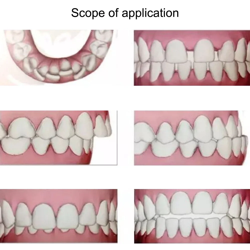 Невидимые Ортодонтические брекеты зубы Стоматологические Ортодонтические брекеты выравнивание инструмент