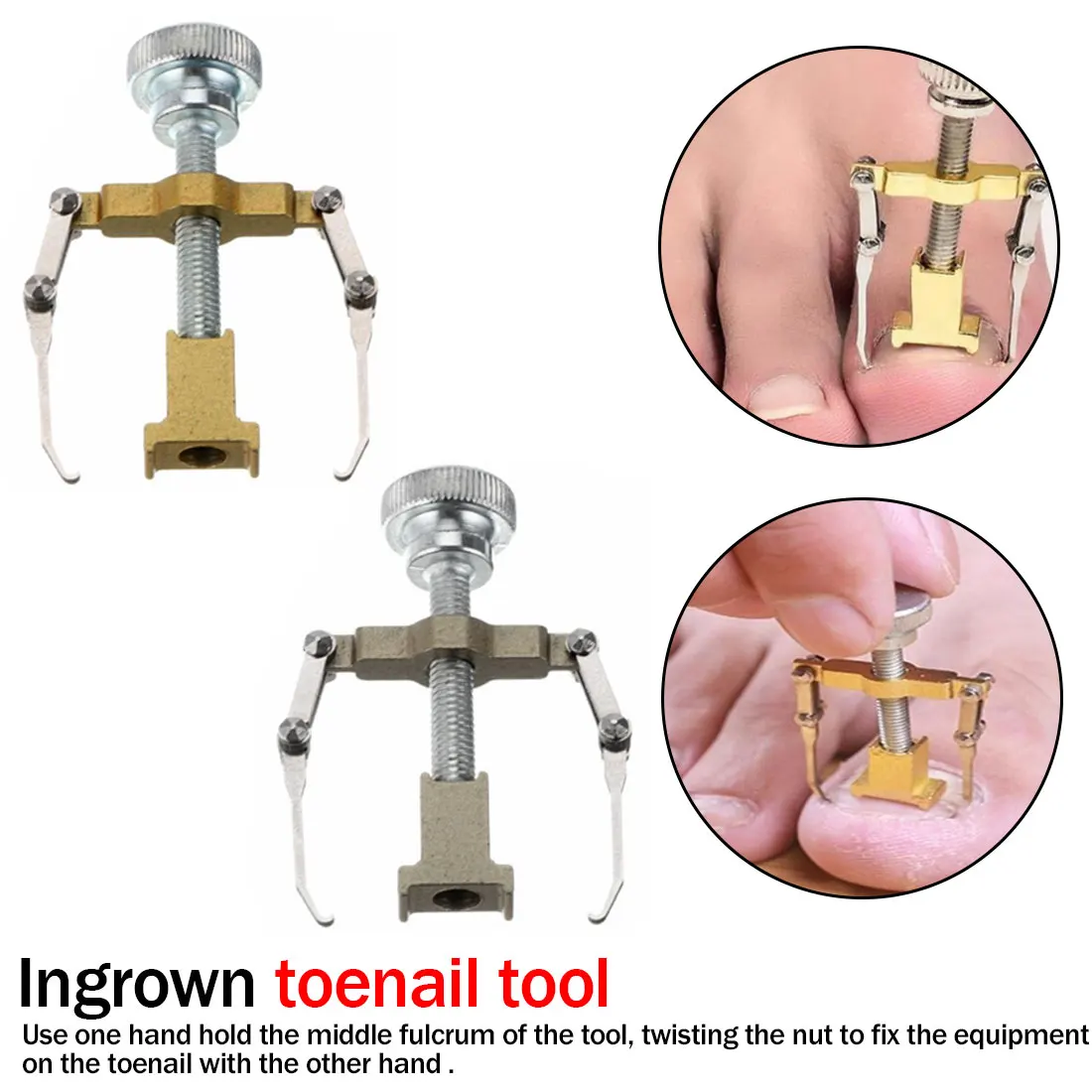 

2 pcs Cuticle Remover Kit Nail Clipper Trimmer for Cuticle Ingrown Nails Pedicure Manicure Corrector Fixer