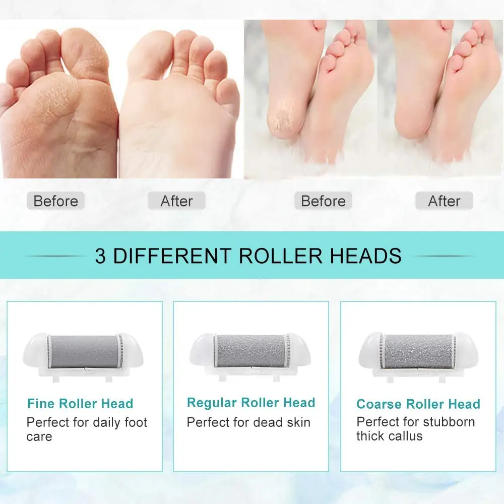 Foot Care Tool Heads Pedi Dead Hard Skin Callus Remover Refills Grinder Replacement Rollers File Feet Care Tool