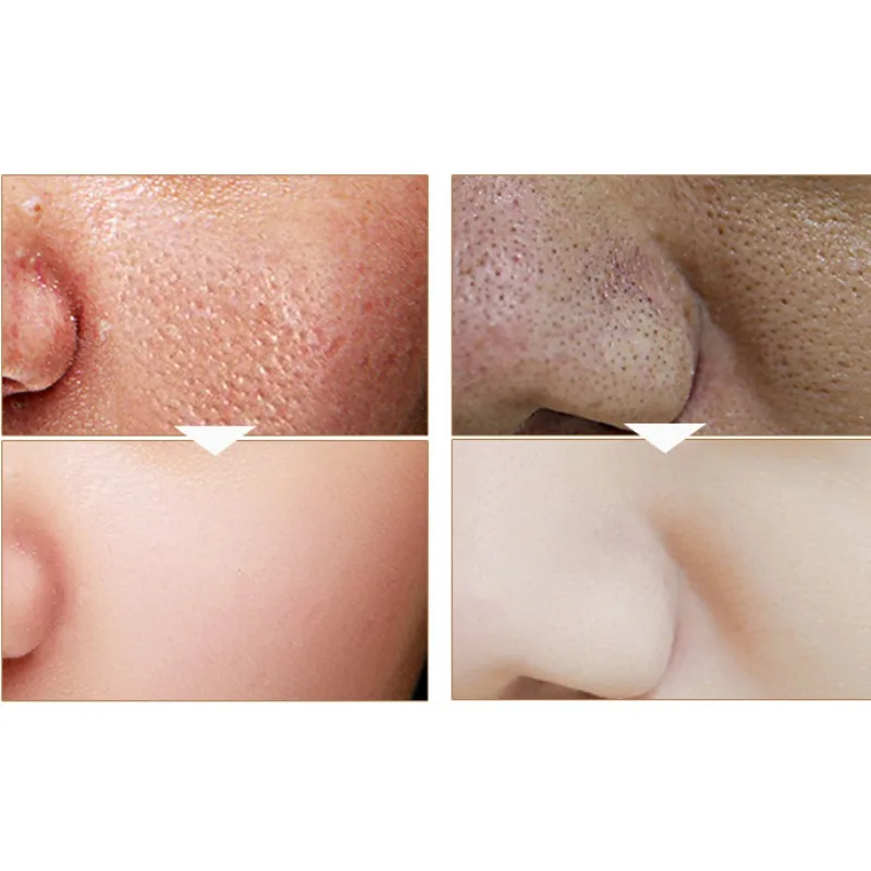 Золотая маска blackhead удаление крем для лица против морщин и уход за кожей лица отшелушивающая маска Красота средство от черных точек акне шрам глубокое очищение грязевая