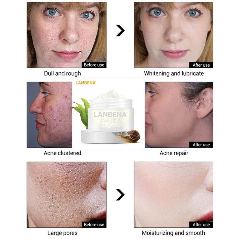 LANBENA Snail Cream For Face Whitening Moisturizing Repair Snail Face Whitening Cream Anti Wrinkle Anti Aging 1 LANBENA Snail Cream For Face Whitening Moisturizing Repair Snail Face Whitening Cream Anti Wrinkle Anti Aging 5