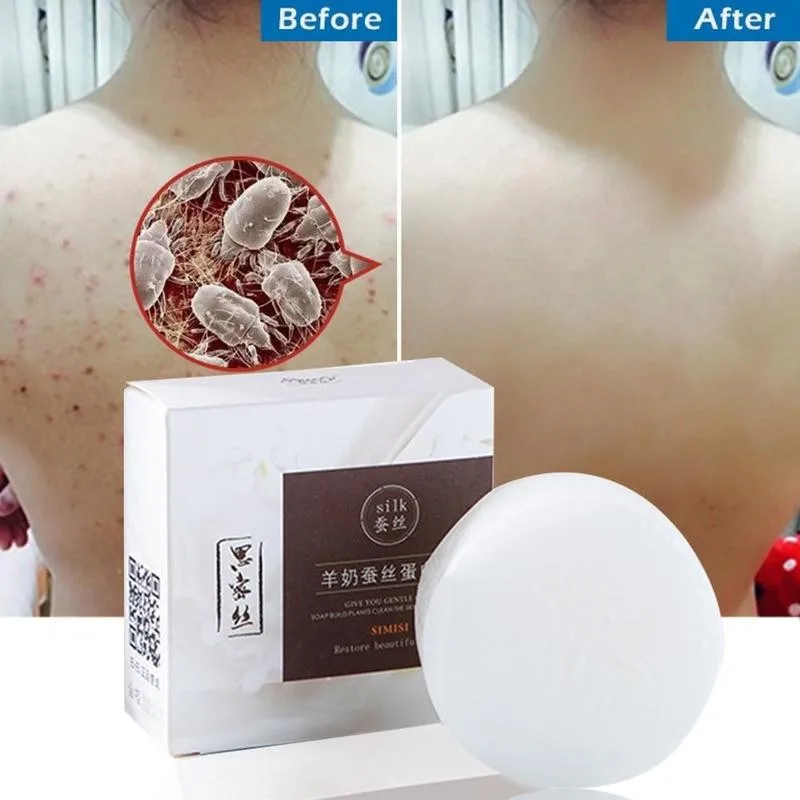 

2020 Pin Up Goat Milk Soap Natural Silk Foam Best Wash Acne Control Skin & Care & Mites Bath & Pimple Oil Blackheads Remove V8Z5