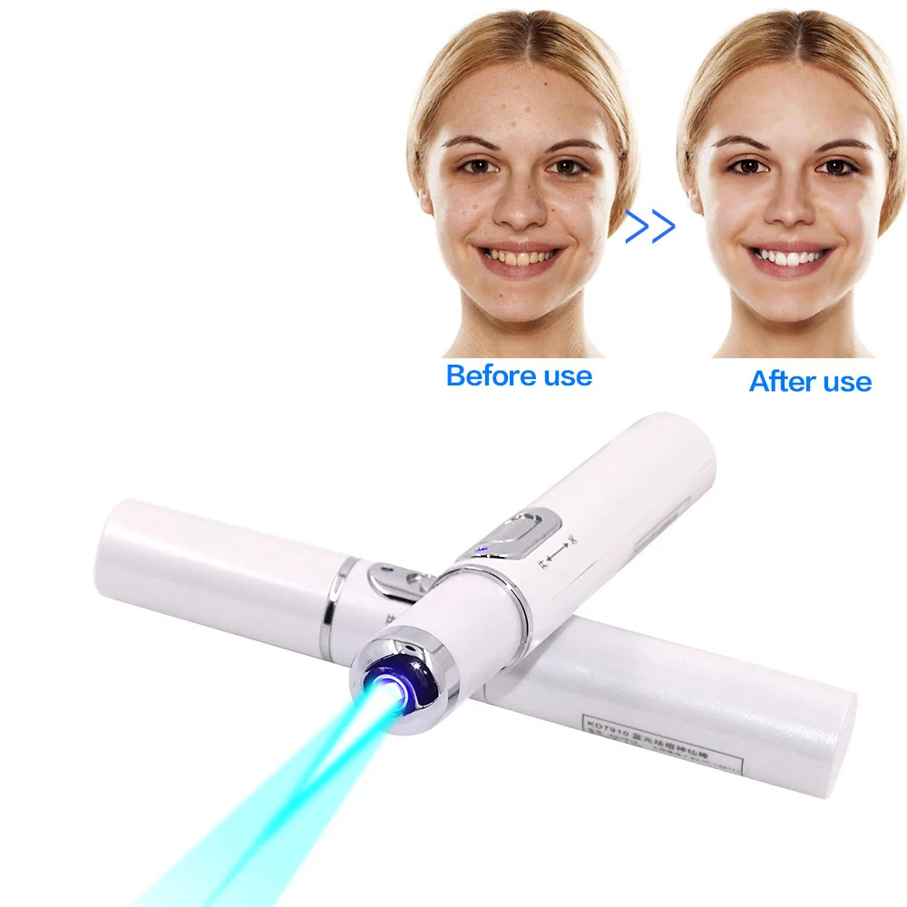 Portable Acne Laser Pen Wrinkle Removal Machine Durable Soft Scar Remover Device Light Therapy Pen Massage Relax Skin Care Tool