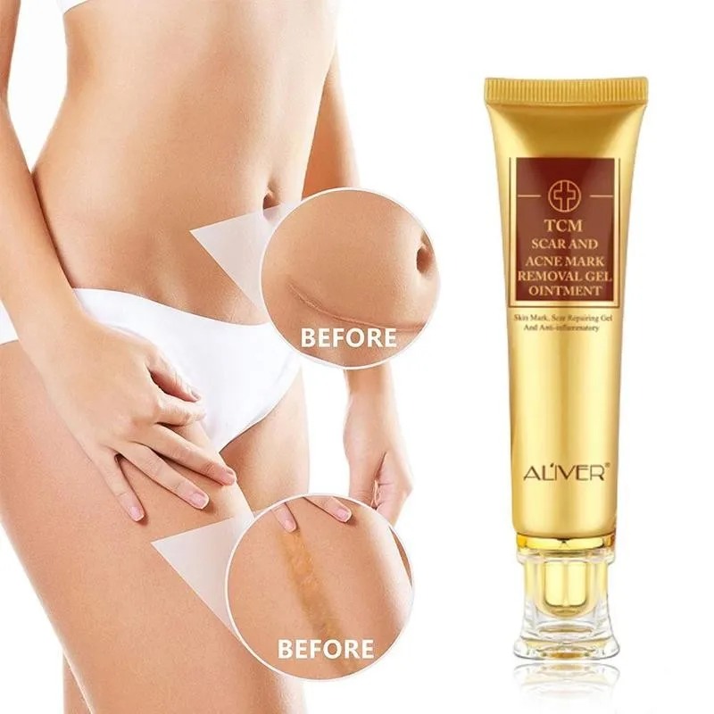 Крем для удаления акне и шрамов 30 мл| |